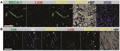 Graphene-Derived Materials Interfacing the Spinal Cord: Outstanding in Vitro and in Vivo Findings